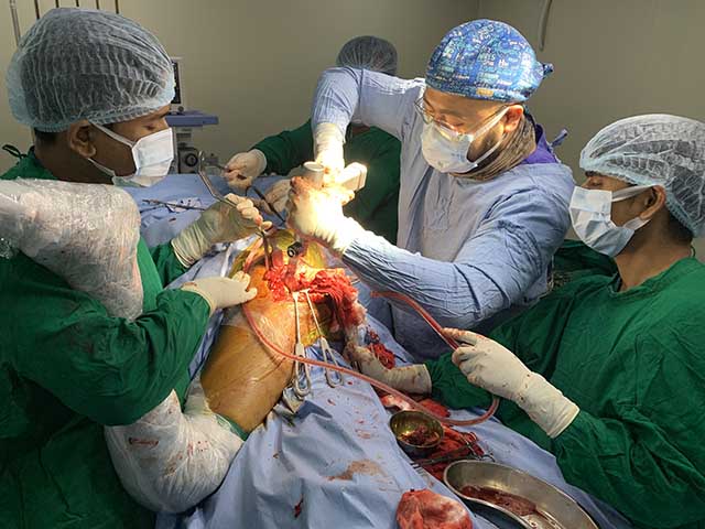 Cemented Bipolar Hemiarthroplasty